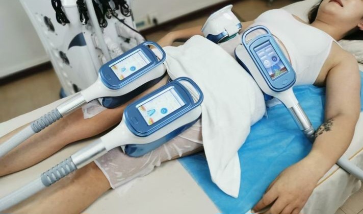 A Cryo-T-Shock hősokkterápiás zsírfagyasztás